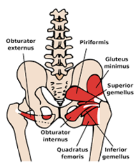 tendinitis gluteo medio